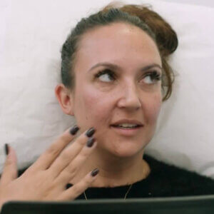 Chloe lip fillers London