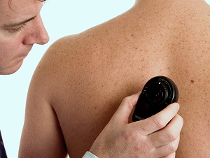 mole-check