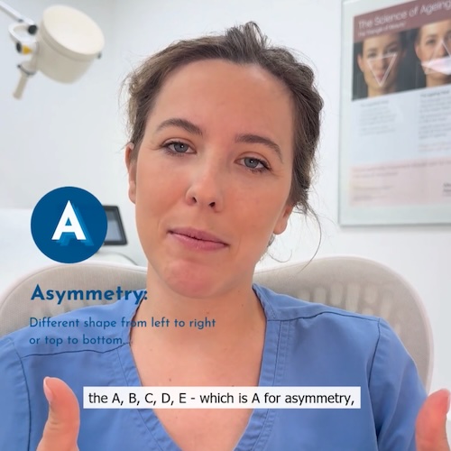 ABCDE Mole Check Dr Lydia Ioannidi
