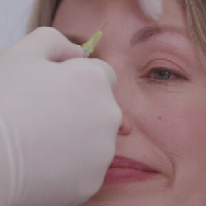 BOTOX treatment London
