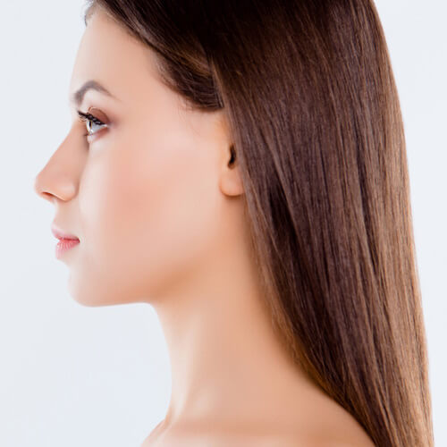 chin enhancement filler injections