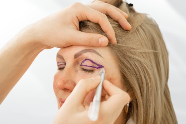 Hooded Eyelids