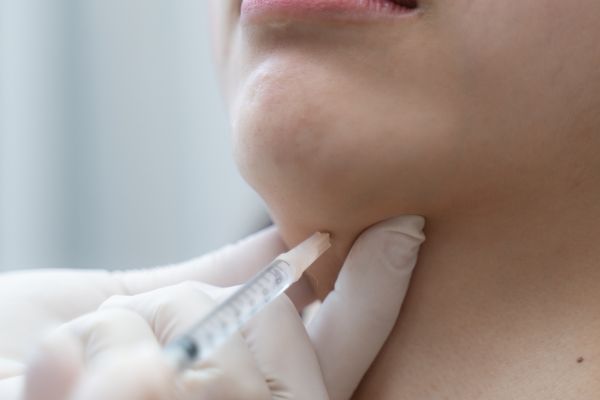 belkyra injections