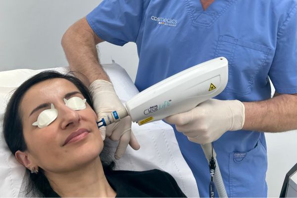 Clearlift Laser Treatment