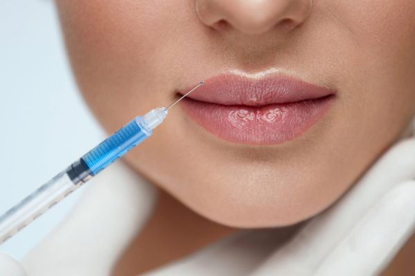 Lip Enhancement Filler