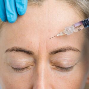 Botox Migraine Treatment