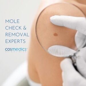 Mole Check Removal Experts