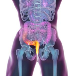 Haemorrhoids Diagram